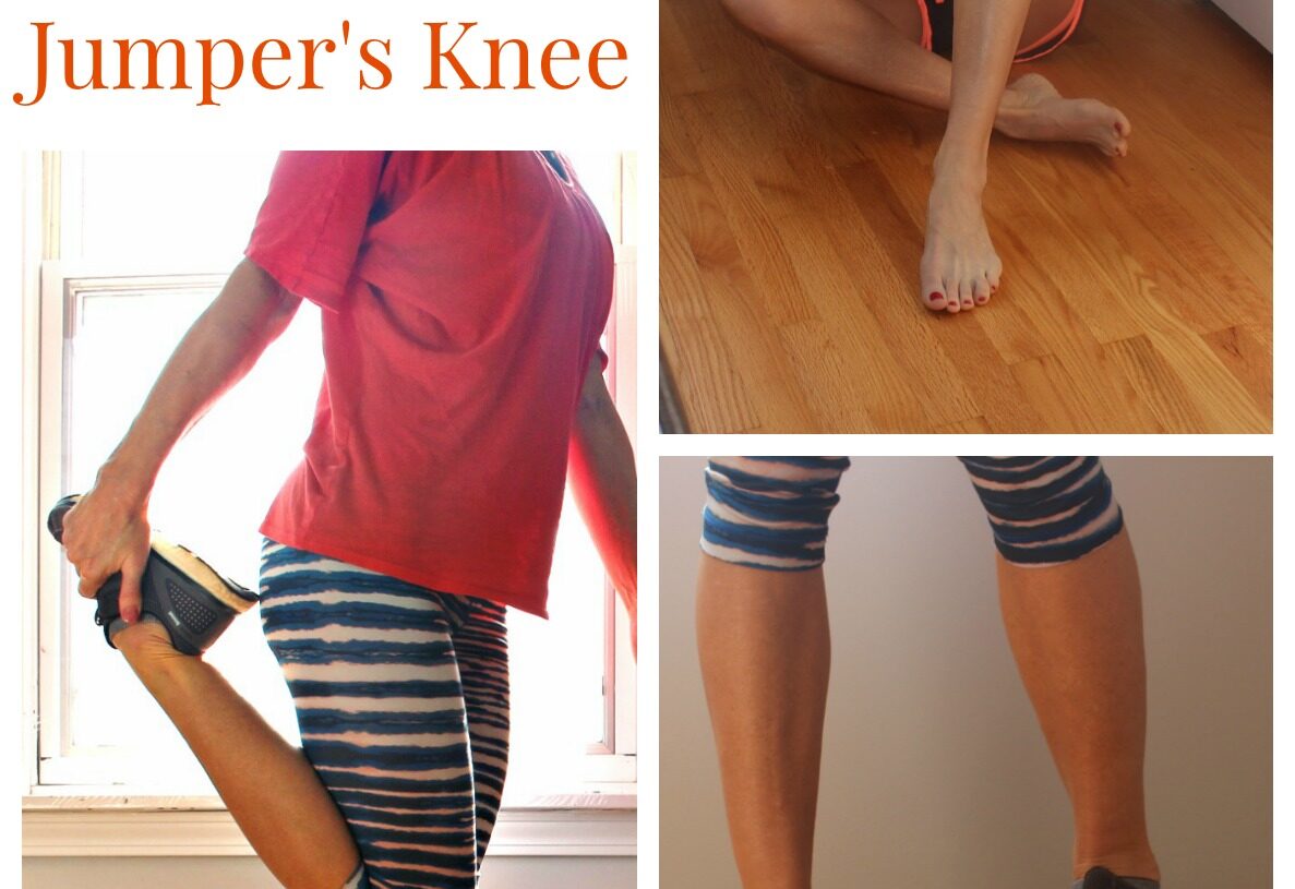 How to Recover From Jumper’s Knee (My Story with Patellar Tendonitis)